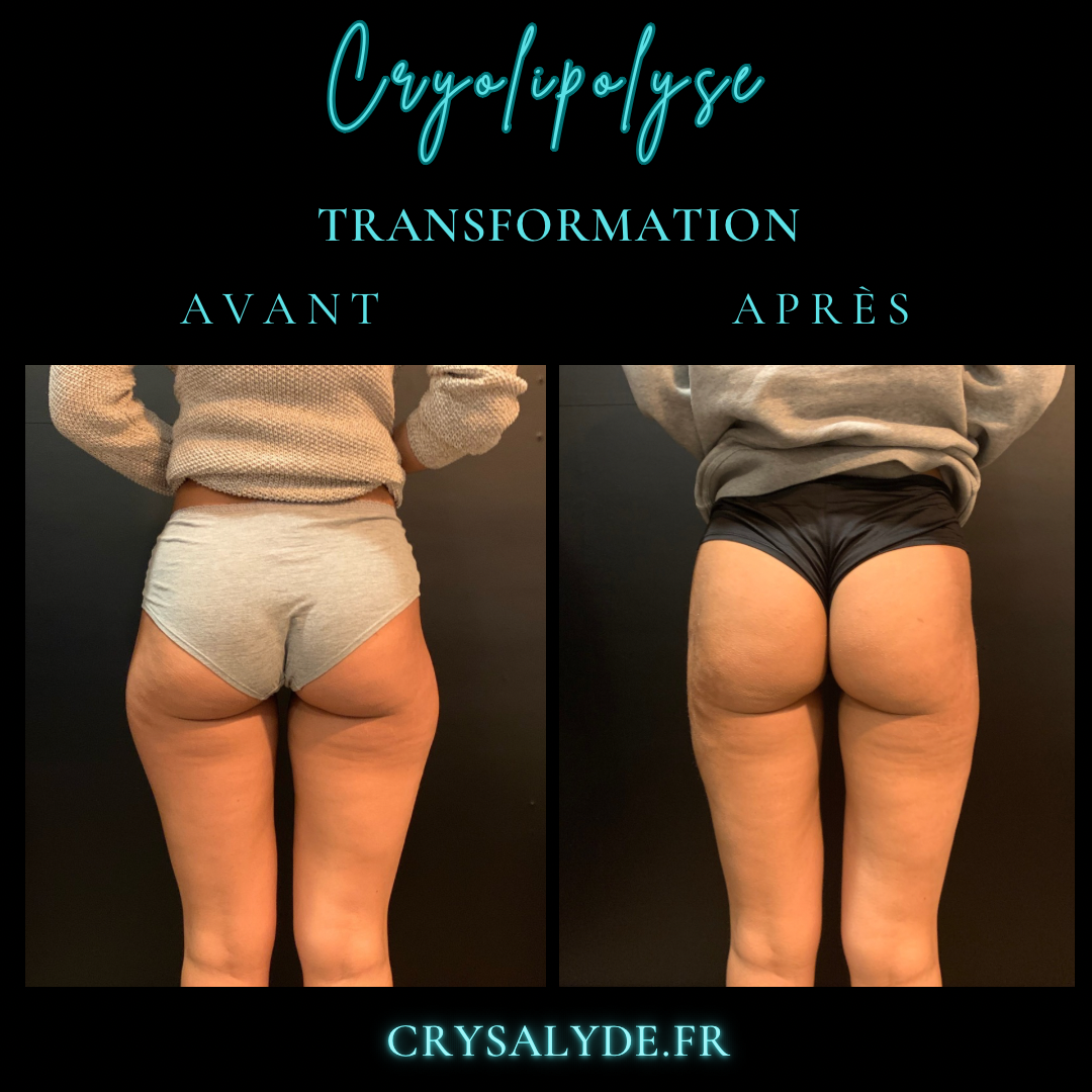 transformation avant et apres